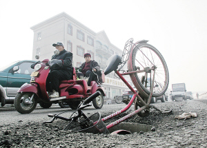 清晨骑车栽进无盖井 不幸摔了满脸伤共缝11针